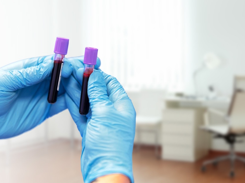 Odběrová místnost CITYLAB s.r.o. - I. Všeobecná poliklinika Kladno